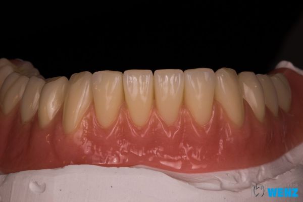 dentalllabor-wenzoliver-wenz-10604982A6-1B1E-AB86-8C49-C6B122250DA9.jpg