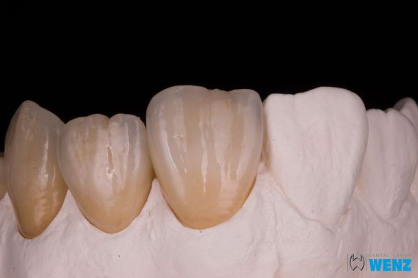 dentalllabor-wenzoliver-wenz-11318EF19A-ED2E-5A1C-EC08-ACD3DE7DB840.jpg