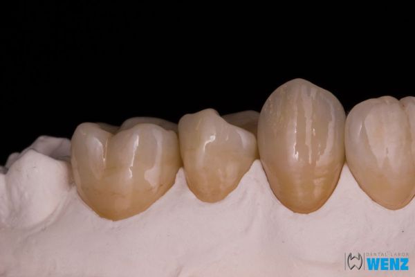 dentalllabor-wenzoliver-wenz-122C379945-0353-96F6-9CFA-AA7315BBE676.jpg