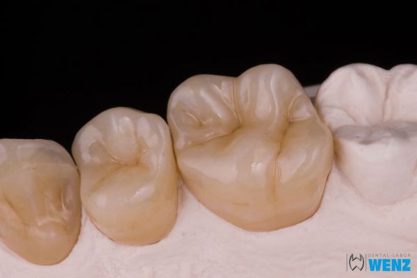 dentalllabor-wenzoliver-wenz-13216F7104-EDE0-B97B-9022-AB1D953F5383.jpg