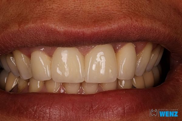 dentalllabor-wenzoliver-wenz-13E6A1F49-0722-8512-BD79-6749A4E88B86.jpg