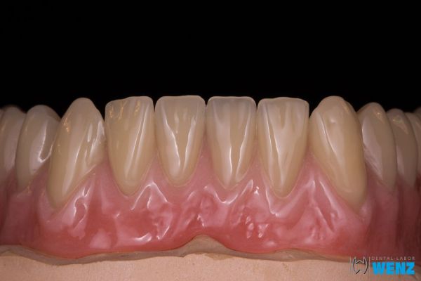 dentalllabor-wenzoliver-wenz-14DBDFF8DD-367C-5D10-B3F5-52C7814A2260.jpg