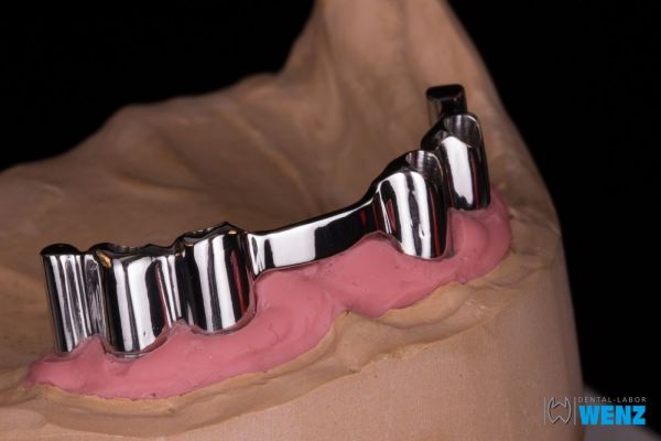 dentalllabor-wenzoliver-wenz-15-14B5146FD-CC6E-7B21-A9F3-A0BE01C08904.jpg