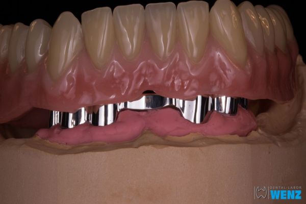 dentalllabor-wenzoliver-wenz-16D23F7DDE-71B6-547F-F2EC-D3237BD4AF99.jpg