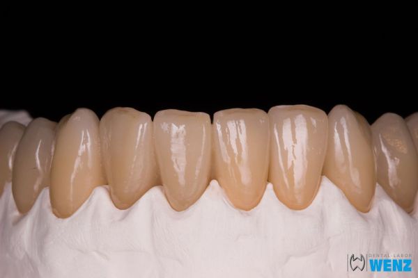 dentalllabor-wenzoliver-wenz-178ABBA2B4-AC5F-A341-4F66-6F45045C0C8B.jpg