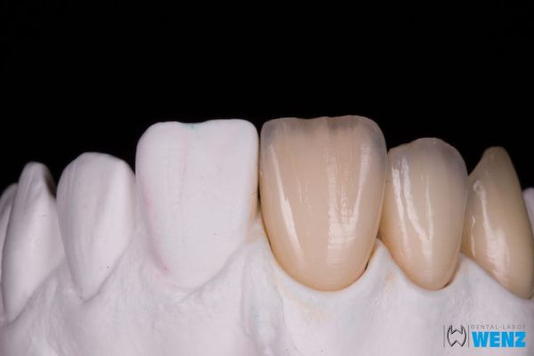 dentalllabor-wenzoliver-wenz-20D2B1B345-6D06-31A1-7609-AA44B7168382.jpg