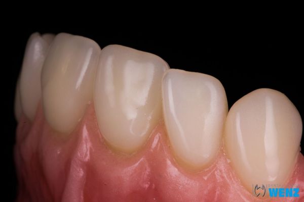dentalllabor-wenzoliver-wenz-2325957843-C554-E841-4159-6666D35B5A5C.jpg