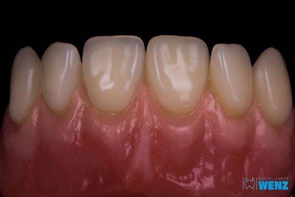 dentalllabor-wenzoliver-wenz-24246576B1-FDFB-F3D0-552B-AAB481FFAA95.jpg