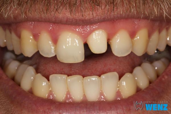 dentalllabor-wenzoliver-wenz-2D9CFC684-D3D2-43AE-6758-0BDD7664433E.jpg