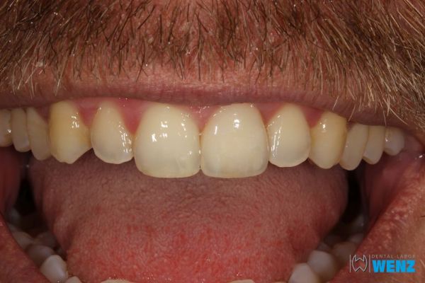 dentalllabor-wenzoliver-wenz-37297CAD5-3360-9061-28D9-F3A13AA697A1.jpg