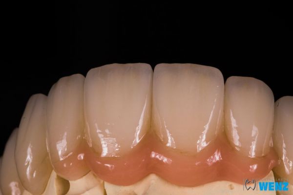 dentalllabor-wenzoliver-wenz-463E32258-6FCA-B55A-9310-DB3CE0AE17AC.jpg