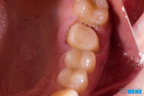 dentalllabor-wenzoliver-wenz-52E9CF733-E5AD-33A0-FF53-CEFB9377A2D6.jpg
