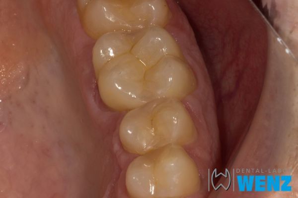 dentalllabor-wenzoliver-wenz-62CC316CA-69C0-A749-DED4-29886E1B32EE.jpg