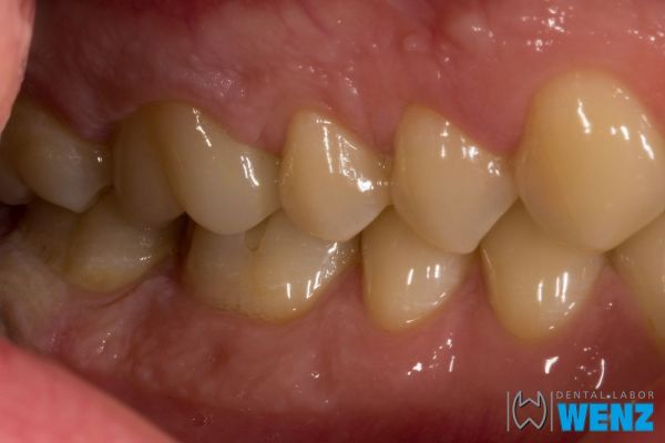 dentalllabor-wenzoliver-wenz-7583FFE9C-539A-1A44-0ADA-1DA2C27387B6.jpg