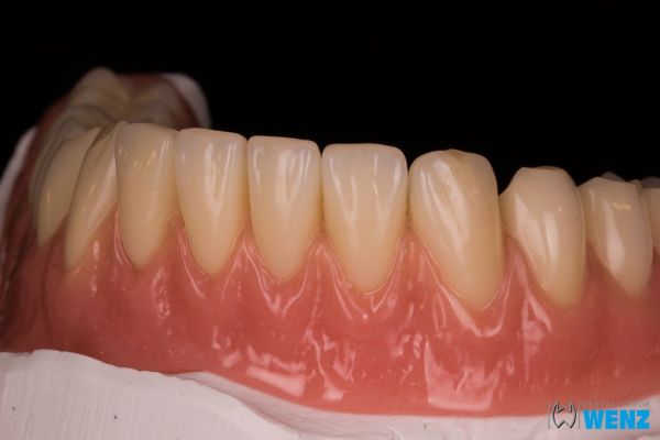 dentalllabor-wenzoliver-wenz-9973F28F6-16A7-E531-776B-346CD15D2CEB.jpg